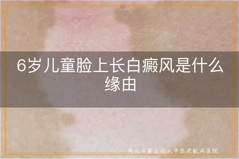 6岁儿童脸上长白癜风是什么缘由