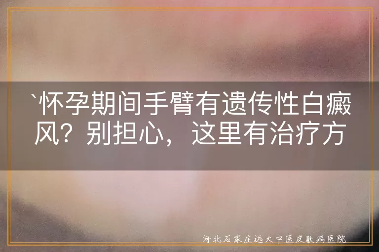 怀孕期间,手臂,遗传性白癜风,治疗方法,药物,光疗,饮食调整,心理护理,防晒