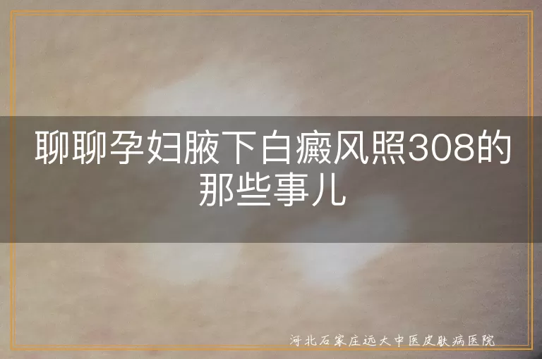 孕妇,白癜风,308准分子激光治疗,费用,治疗前准备,治疗后护理