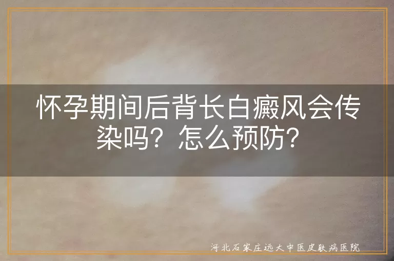 怀孕期间,白癜风,传染,预防,合理饮食,防晒,心态,化学物质,孕检