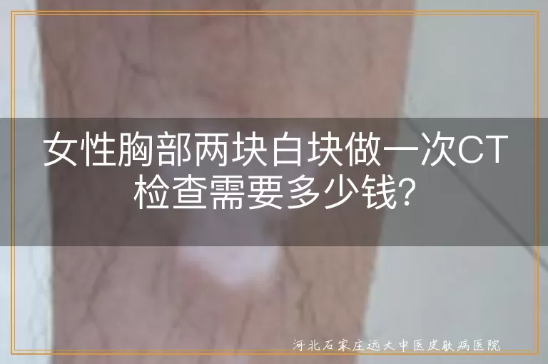 女性胸部白块,CT检查费用,地区差异,医院等级,检查类型,医保政策