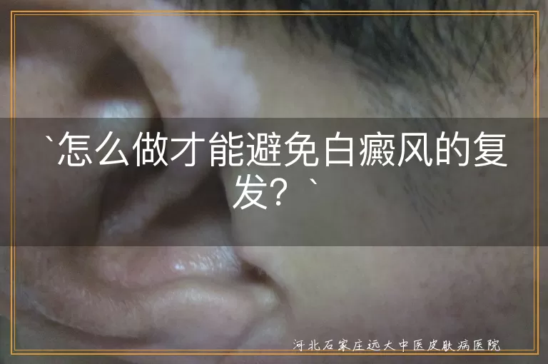 白癜风,复发,防晒,饮食调整,规律作息,避免外伤,心情愉悦,定期复诊