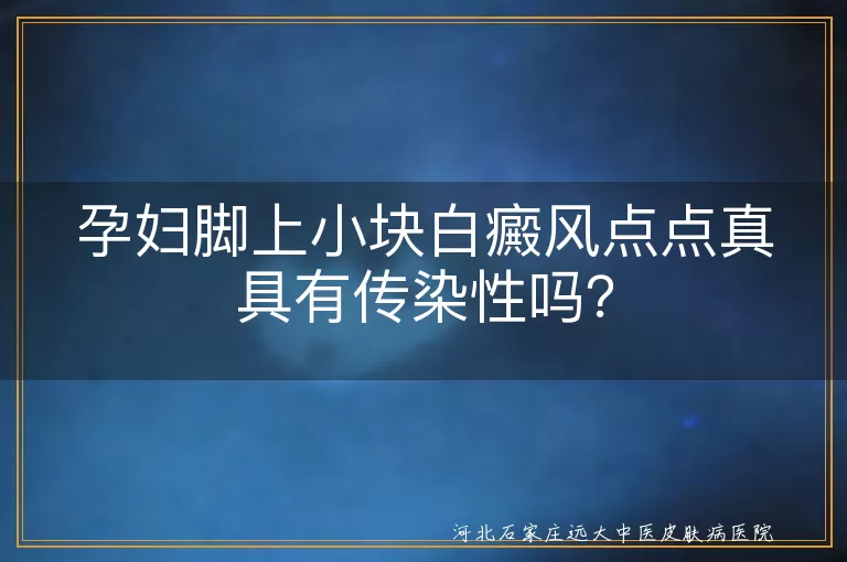 白癜风,孕妇,传染性,治疗,心态