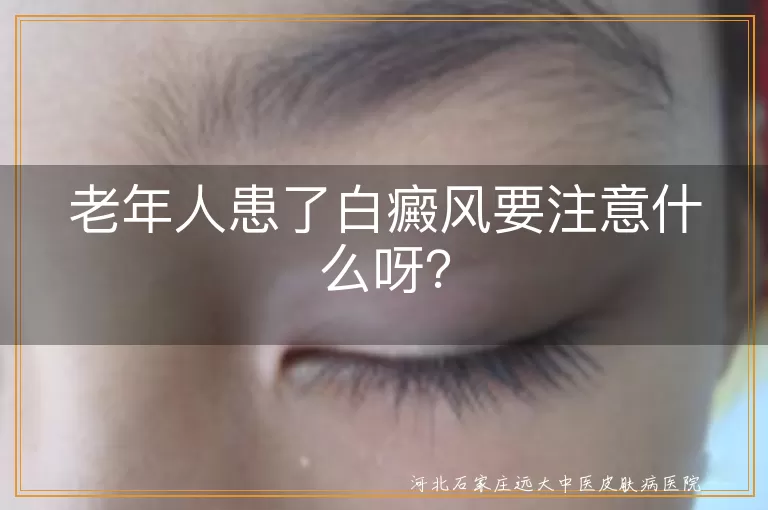 老年人,白癜风,心情,饮食调理,皮肤保护,规律作息,定期检查,避免盲目用药