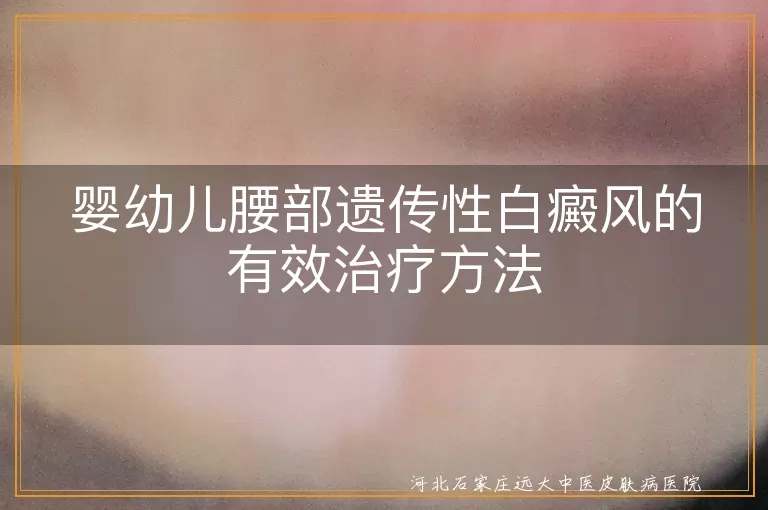 婴幼儿,腰部,遗传性白癜风,治疗方法,综合治疗,家长心态