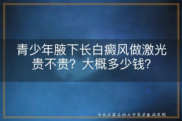 青少年白癜风,激光治疗,费用,病情轻重,医院等级,地区差异