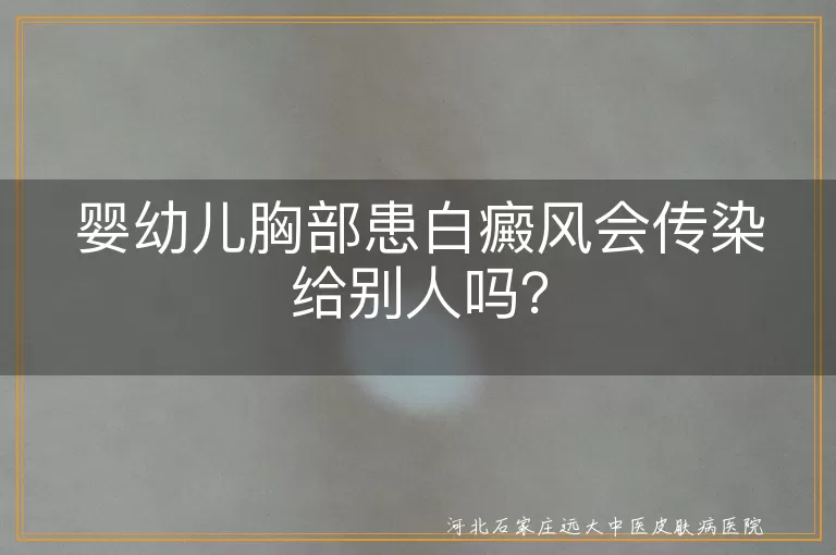 婴幼儿,白癜风,传染,治疗,预防