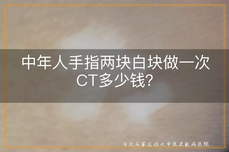 手指白块,CT检查,价格差异,医院等级,地区差异,检查类型,医保报销