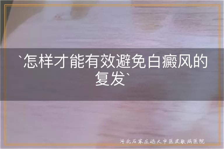 白癜风,复发,预防,生活习惯,心情,皮肤保护,定期复查