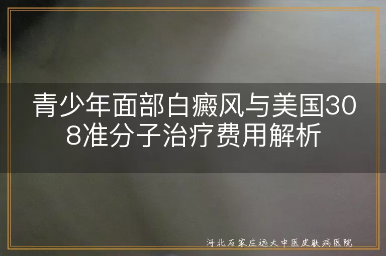 青少年白癜风,美国308准分子激光,治疗费用,地区差异,医院级别,设备选择,治疗周期,病情严重程度