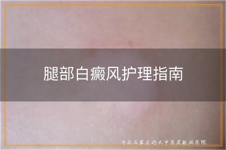 腿部白癜风日常护理,白癜风饮食调理方法,白癜风患者心情管理,白斑皮肤清洁保湿