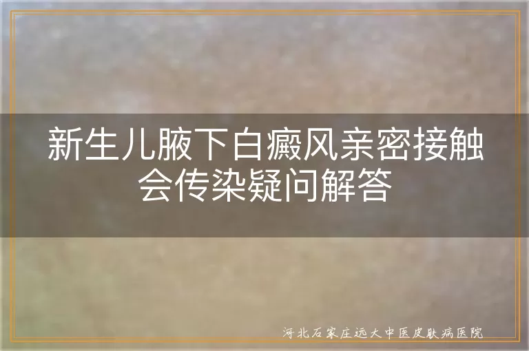 新生儿白癜风是否会传染,白癜风亲密接触安全性,白癜风非传染病,白癜风患者关爱与接纳