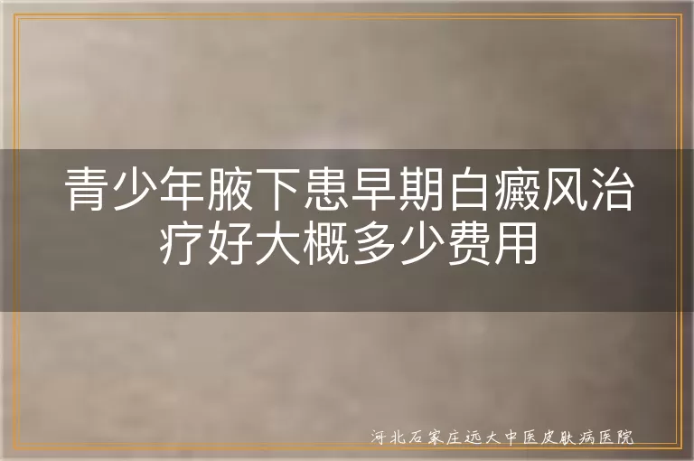 青少年腋下白癜风治疗费用, 早期白癜风治疗费用概览, 白癜风不同治疗方法费用, 白斑治疗费用影响因素