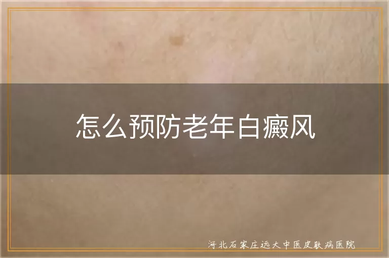 老年人如何避免白癜风,饮食预防白癜风方法,皮肤保护预防白斑,定期检查防白癜风