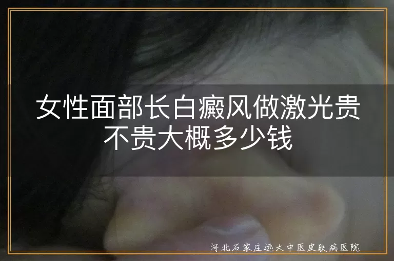 女性白癜风激光治疗费用, 白癜风治疗费用因素, 激光治疗白斑费用, 白斑激光治疗多少钱