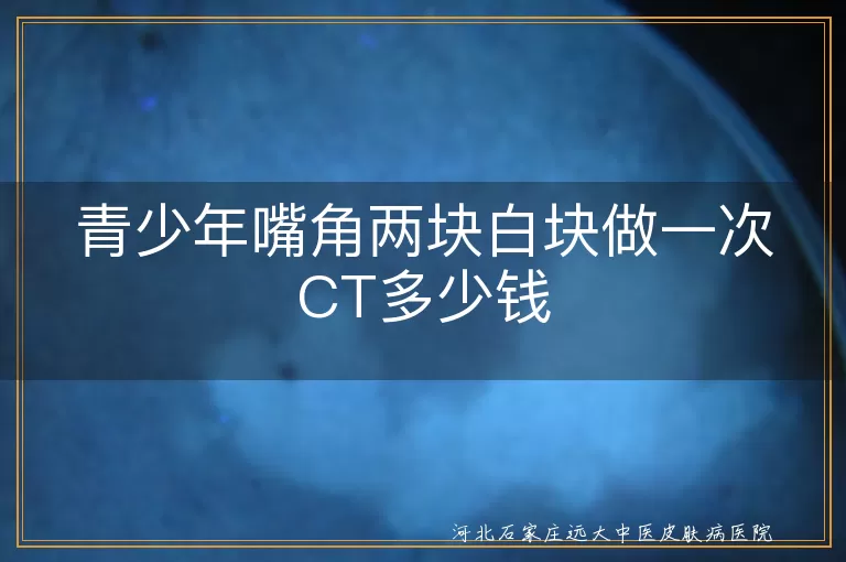 青少年嘴角白斑检查费用, 白癜风诊断方法, 嘴角白块检查多少钱, 白斑检查费用