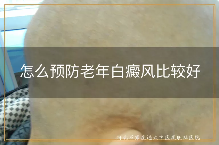 老年人白癜风预防方法,健康饮食防白癜风,适当运动防白斑,定期体检防白癜风