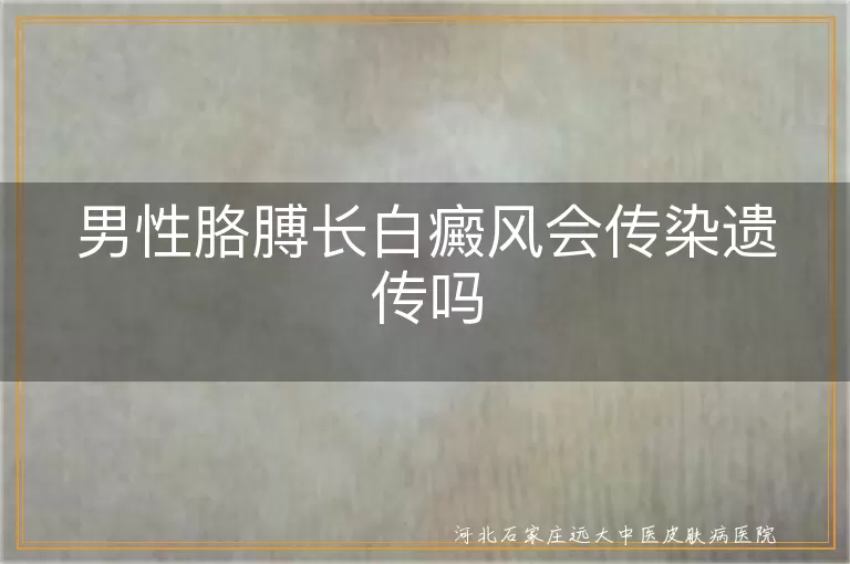 男性白癜风是否会传染,白癜风遗传给孩子的概率,白癜风治疗方法,白癜风心理支持