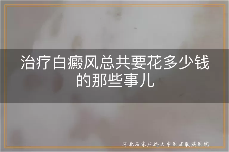 白癜风治疗费用,白斑治疗成本,白癜风治疗价格,白斑康复花费