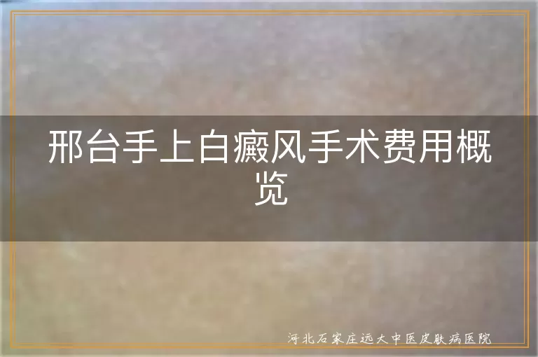 邢台白癜风手术费用, 手上白癜风治疗费用, 白癜风手术费用概览, 白斑手术治疗多少钱