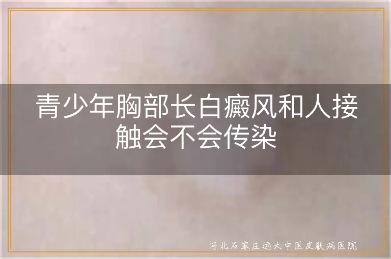 青少年白癜风传染问题,白癜风是否传染,胸部白斑接触安全,白斑病不传染
