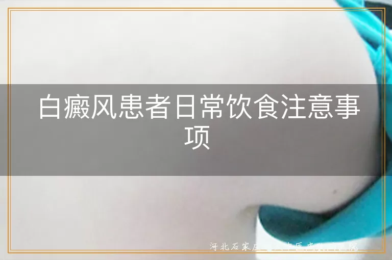 白癜风患者饮食禁忌,白斑饮食调理,白癜风食物选择,白斑饮食注意事项