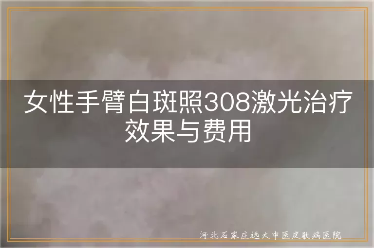 女性白癜风照308激光治疗效果,手臂白斑照308激光费用,白斑治疗308激光效果