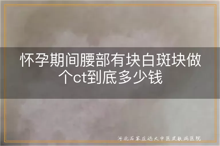 怀孕期间腰部白斑做CT费用,孕期腰部白癜风检查价格,孕妇腰部白斑CT检查多少钱