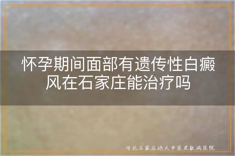 石家庄治疗白癜风医院,怀孕期间白癜风疗法,面部遗传性白斑治疗