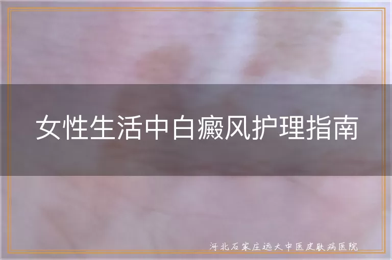 女性白癜风日常护理,白癜风专业治疗方法,白斑心理调适技巧