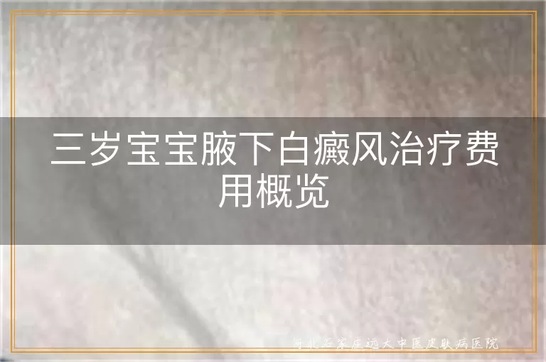三岁宝宝白癜风治疗费用,宝宝腋下白斑治疗预算,儿童白癜风治疗开销