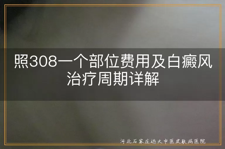 白癜风照308费用多少,白斑治疗周期多长,白癜风多久能康复