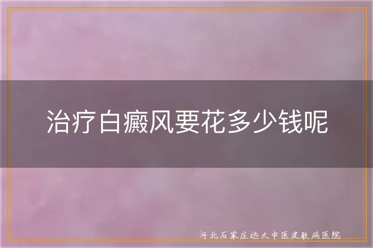 白癜风治疗花费,白斑治疗费用多少,白癜风治疗预算