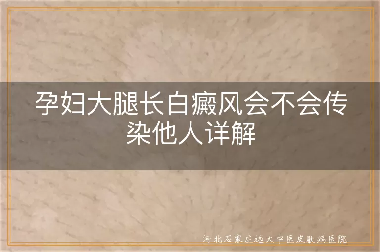 孕妇白癜风传染性,白癜风对孕妇宝宝影响,孕妇白癜风生活注意事项