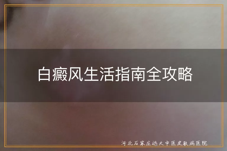 白癜风饮食禁忌,白癜风日常护理要点,白癜风心情调节与运动