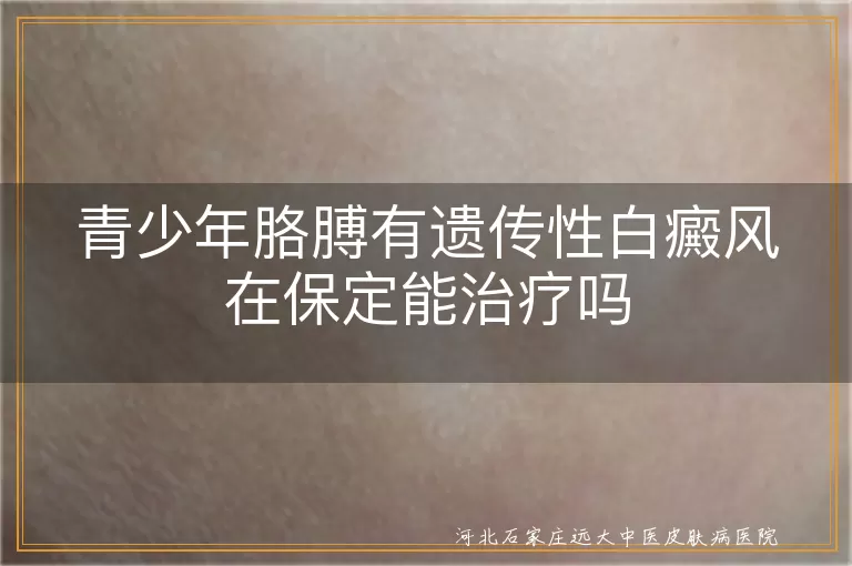 保定治疗青少年白癜风,青少年胳膊遗传性白斑治疗,遗传性白癜风专业治疗