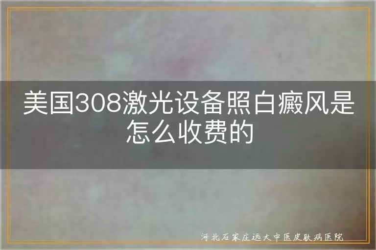 美国308激光治疗白癜风费用, 白癜风308激光收费详情, 白斑308激光照射价格