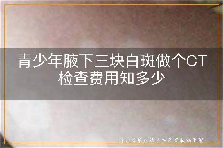 青少年白癜风CT检查费用, 青少年白斑皮肤CT检查多少钱, 青少年腋下白斑检查及治疗费用