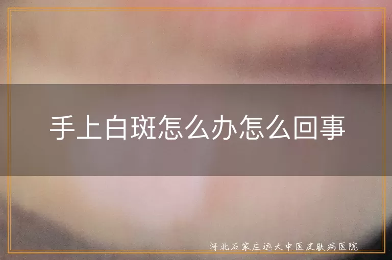 手上白斑出现原因及治疗策略,白癜风引发的手部白斑应对方法,手部白斑诊断与日常护理指南