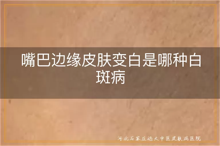 嘴巴边缘皮肤变白是哪种白斑病