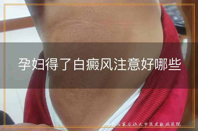 孕妇白癜风日常护理注意事项,妊娠期白斑病情管理要点,孕期白癜风治疗安全指南