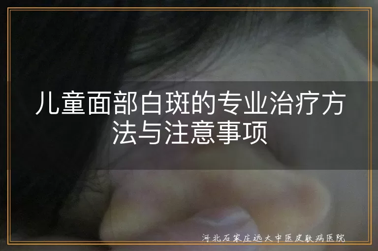儿童面部白斑综合治疗方案,白癜风患儿日常护理要点,儿童白斑病因鉴别与治疗