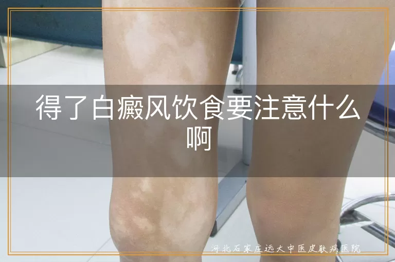 白癜风患者饮食禁忌,白斑患者饮食调整,白癜风饮食营养建议