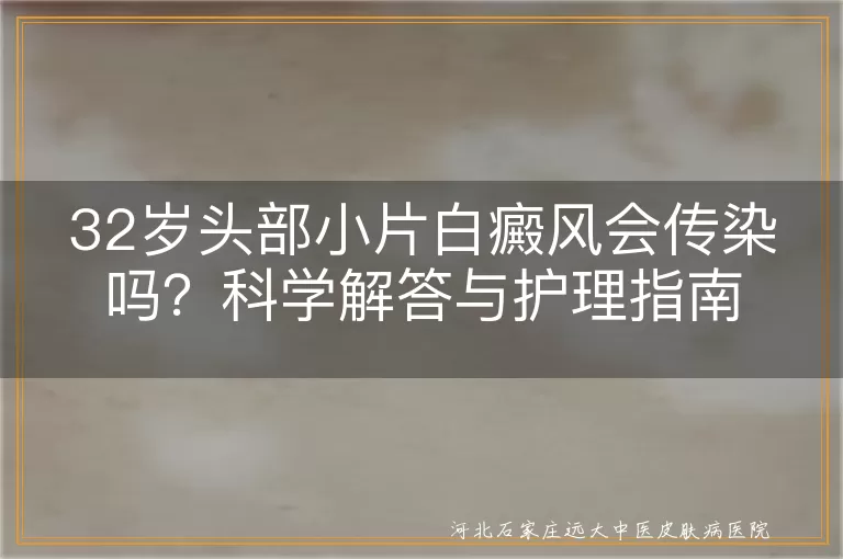 头部白癜风是否传染,白癜风发病机制解析,白斑患者日常护理建议