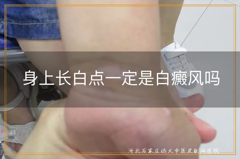 身上白斑与白癜风鉴别方法,皮肤白斑的可能病因有哪些,如何确诊是否为白癜风