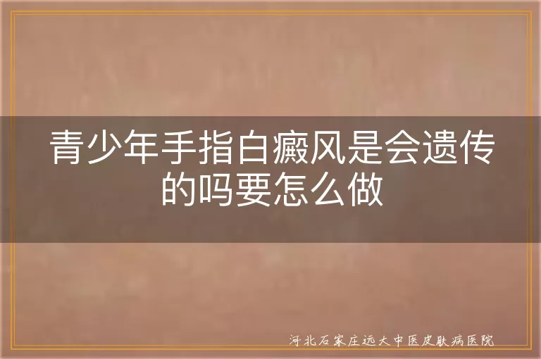青少年手指白癜风遗传风险分析,青少年手指白斑日常护理要点,青少年白癜风科学治疗方案