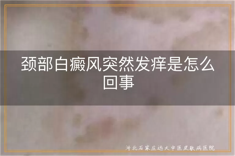 颈部白癜风瘙痒原因分析,白癜风发痒与病情发展关联,白斑部位瘙痒应对措施