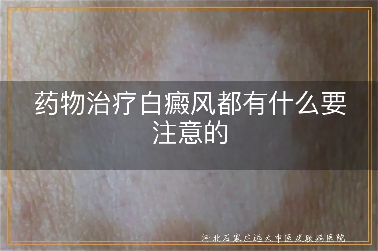 白癜风药物治疗禁忌,白斑患者用药注意事项,白癜风用药疗程管理