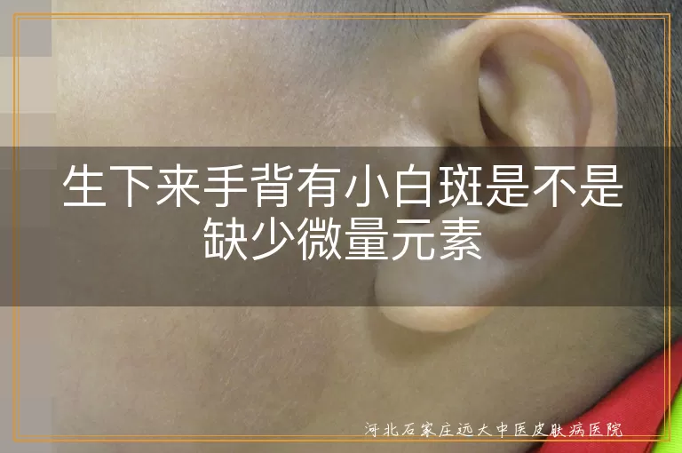 生下来手背有小白斑是不是缺少微量元素