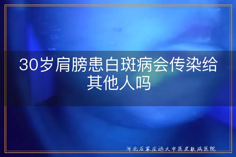 30岁肩膀出现白癜风会传染吗,白斑病在肩部是否有传染性,肩膀白斑症状是否具有传染性